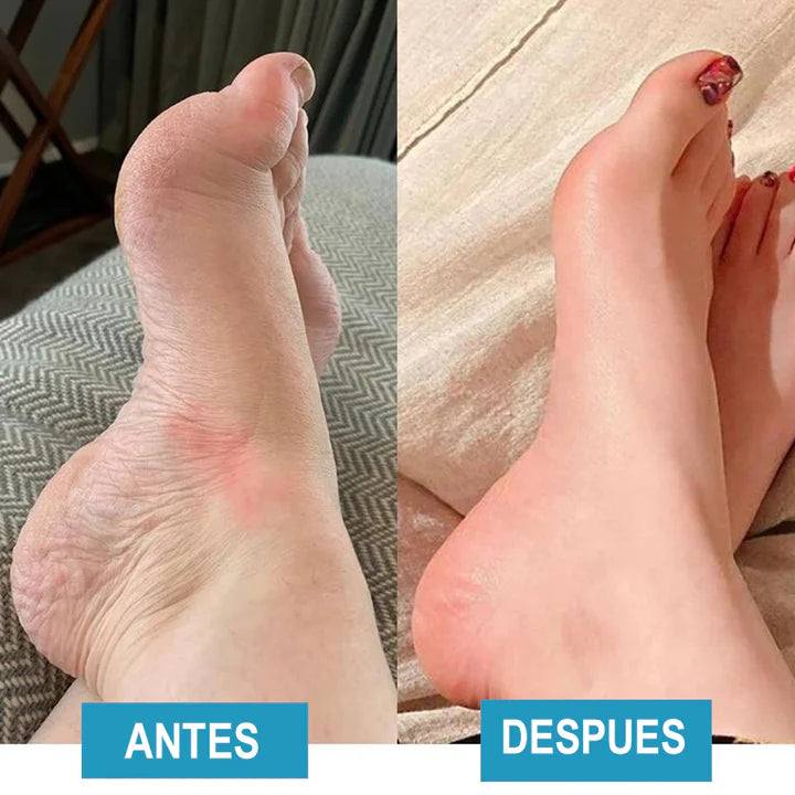 Masajeador de Pies - Para un Alivio Duradero Del Dolor de Pies